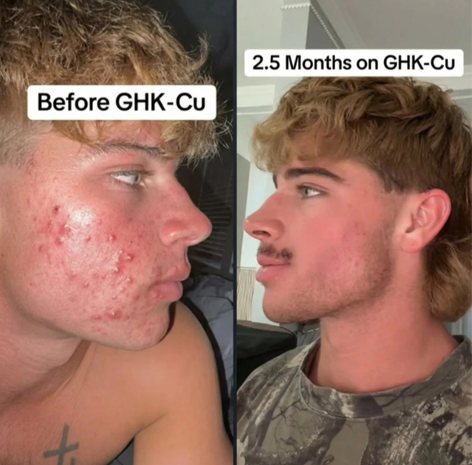 Radiant Renewal Facial Serum